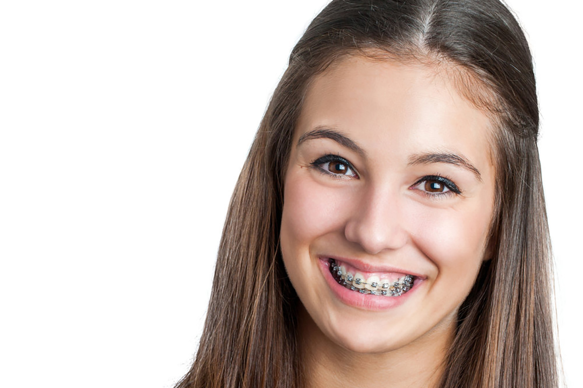 Affordable Braces On Any Budget Summit Dental & Orthodontics