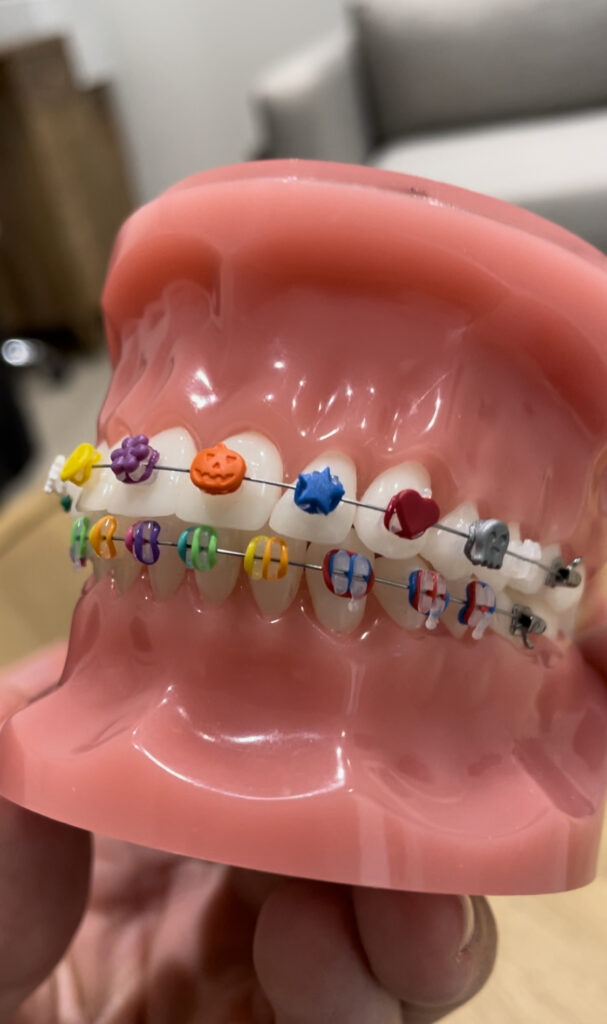 Braces in Davis County